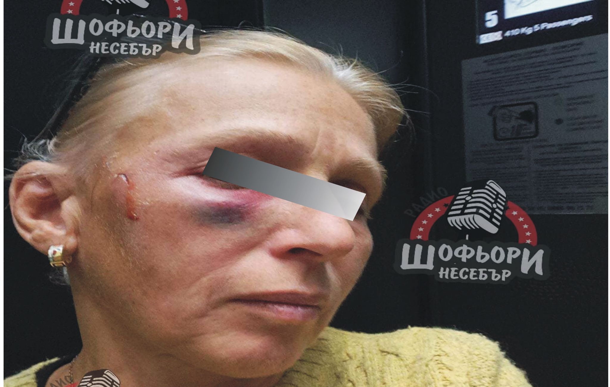 Жена е нападната от три “Добермана” в Несебър на “Южен Плаж” рано сутринта /СНИМКИ/